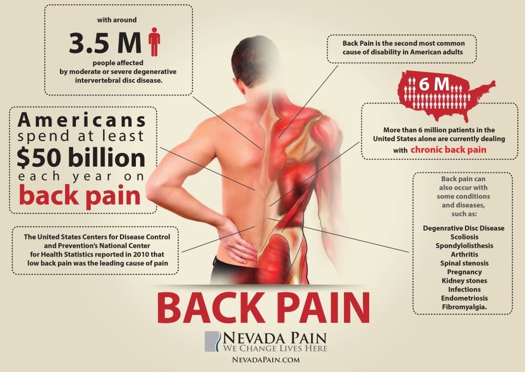 Back Pain Infographics