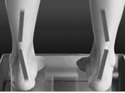 The Best Women’s Shoes for Supination