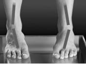 The Best Women’s Shoes for Supination Front Look