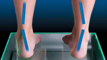 The Best Women’s Shoes for Supination